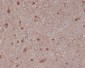 Anti-S100B/S100 Beta Rabbit Monoclonal Antibody